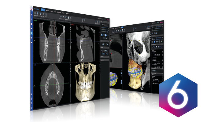 The new Planmeca Romexis® 6.0 highlights usability and streamlines workflows