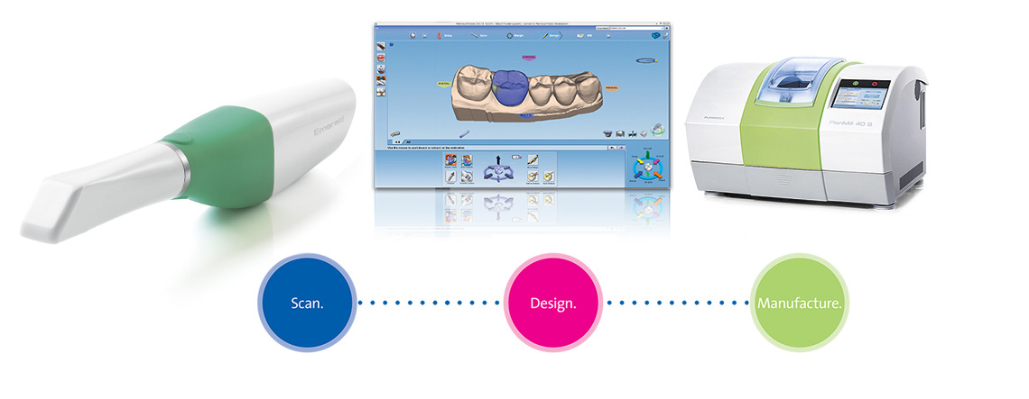 Planmeca FIT® Chairside FAQ – Digital workflow with three simple steps