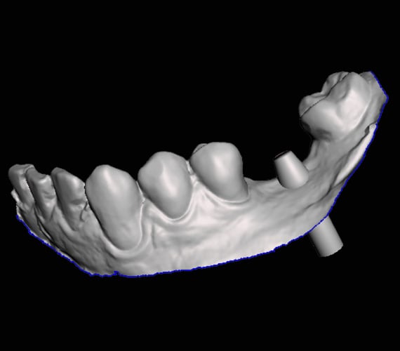 3D imaging software Planmeca Romexis