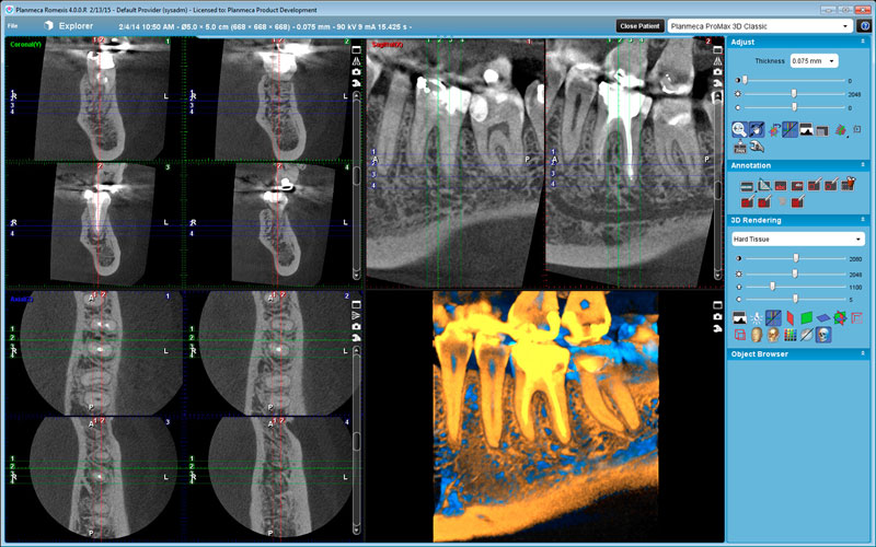 Planmeca Promax 3d Mid User Manual