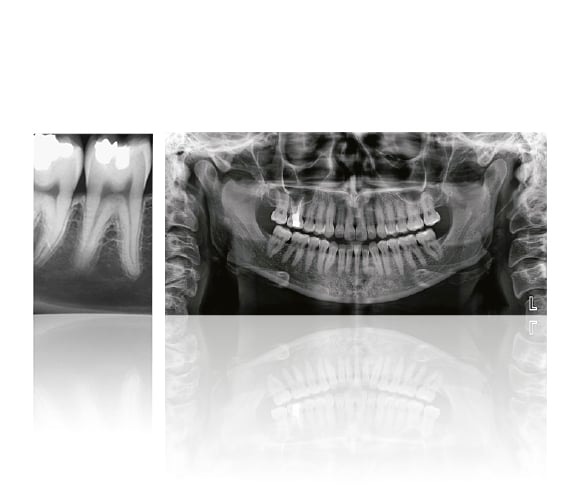 Periodontics