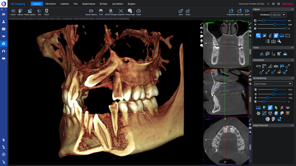 3D Imaging Software | Planmeca Romexis