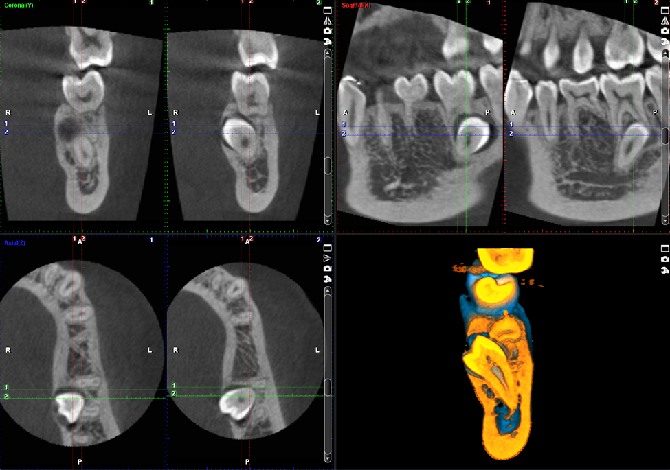 Planmeca ProMax 3D Mid – Extensive CBCT imaging