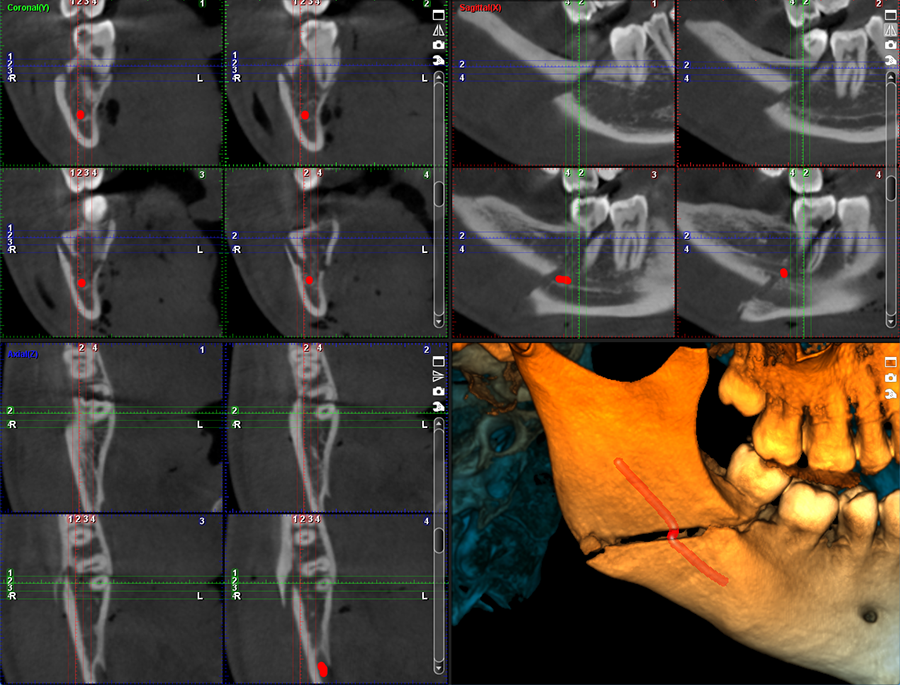 Planmeca ProMax 3D Mid – Extensive CBCT imaging