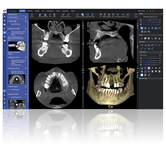 Dental Imaging Software | Planmeca Romexis