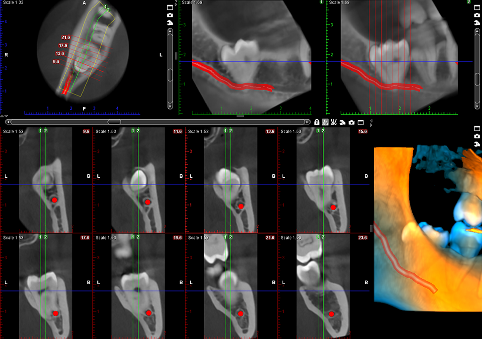 Planmeca ProMax 3D Mid – Extensive CBCT imaging